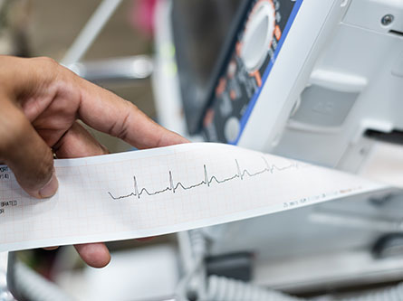 heart specialist looking at ekg results to diagnose heart condition