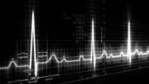 ECG Interpretation