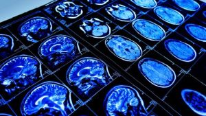 Brain scan images