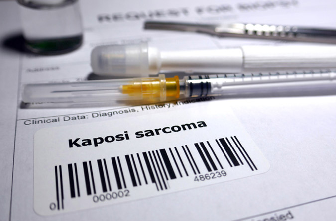 Kaposi sarcoma