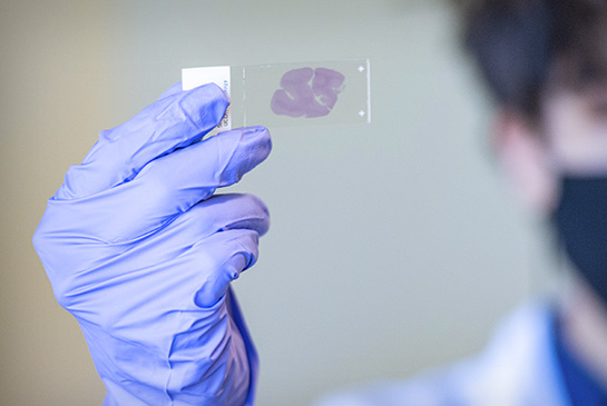 Alzheimer's research lab, researcher holding a slide