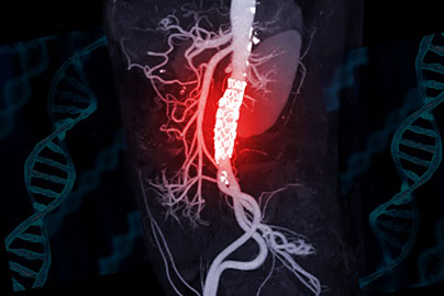 Graphic of heart and arteries with DNA strands on each side.