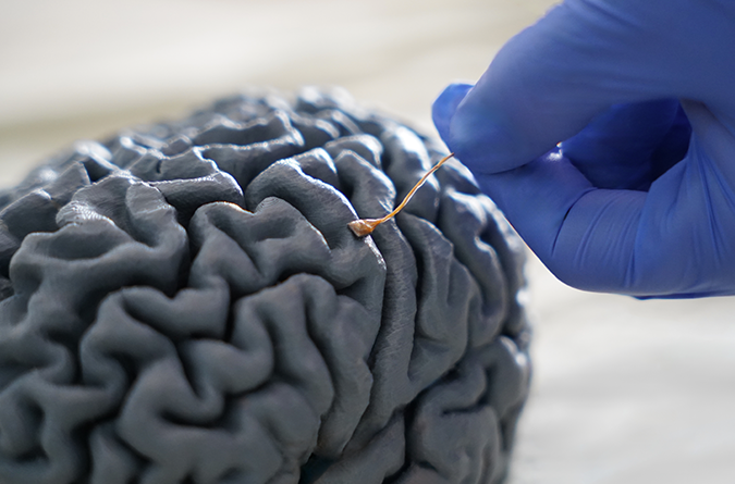 Brain with electrode array