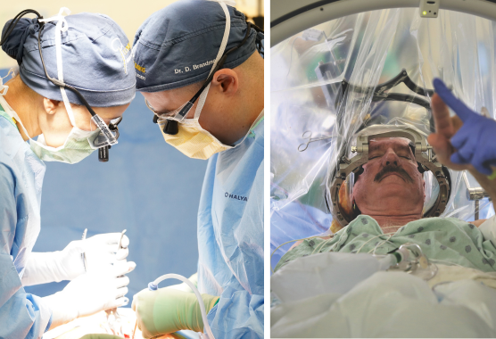 surgeons performing brain surgery on a man