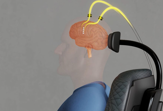brain computer interface model