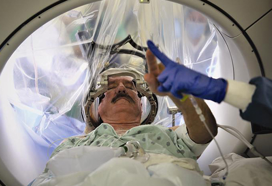 Man undergoing robotic brain surgery