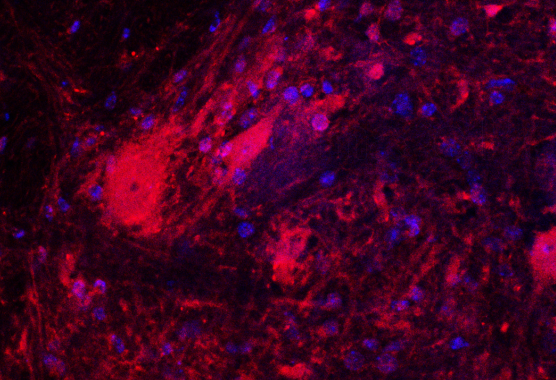Spinal motor neurons of a lethal Chat-mouse model expressing human ChAT rescued by a single ICV injection of an AAV9-CHAT at the dose of 2e 13 vg/kg.