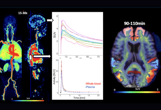 MRI and PET imaging of brain function