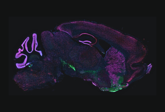 purple brain mri art