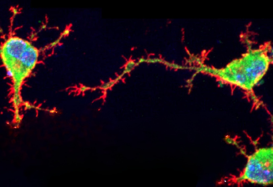myelin glial cell