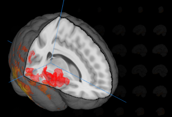 Brain imaging model