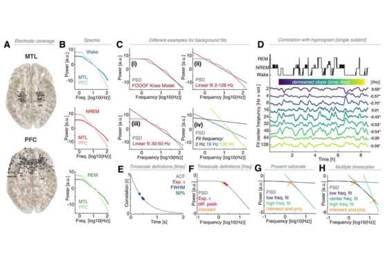 advanced brain recording model