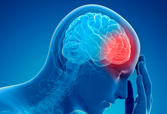 human model with a traumatic brain injury