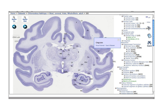 brain map imagery tool