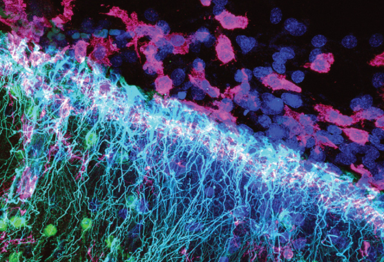 colorful neurons