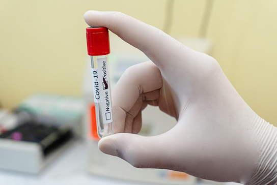 A gloved hand holding a test vial labeled COVID-19 marked positive.