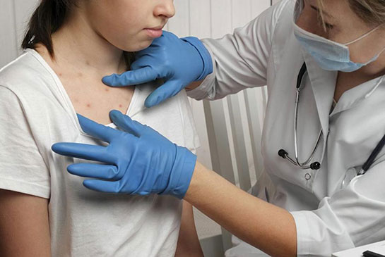 Doctor examines case of measles on adolescent girl in tee shirt