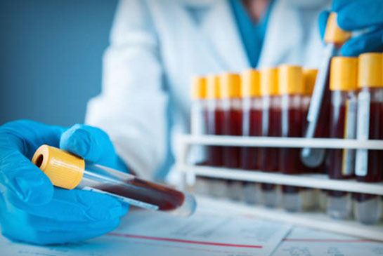 Blood testing, stock image