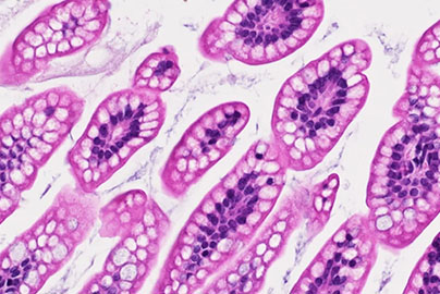 antimicrobial peptides image from Dr. McElroy lab