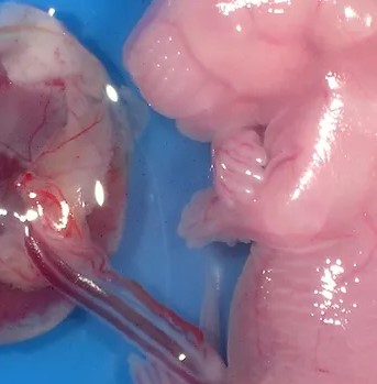 Mouse embryo magnified.