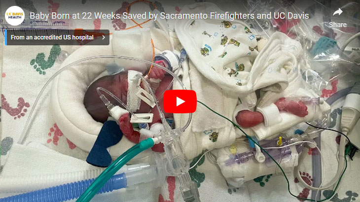 Neonatal baby in NICU at 22 weeks.