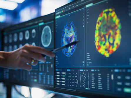 Researcher pointing at brain image, stock photo