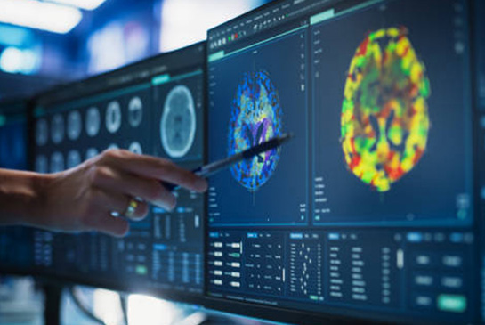 A hand points to a brain scan on a screen