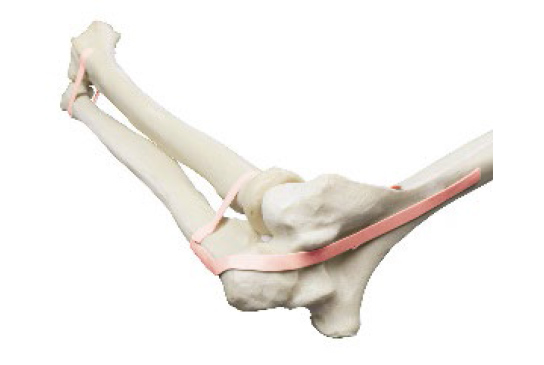 ORTHObones Premium Elbow