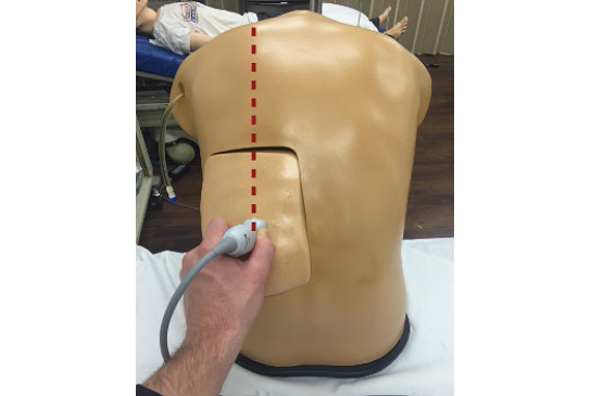 Blue Phantom Thoracentesis Trainer