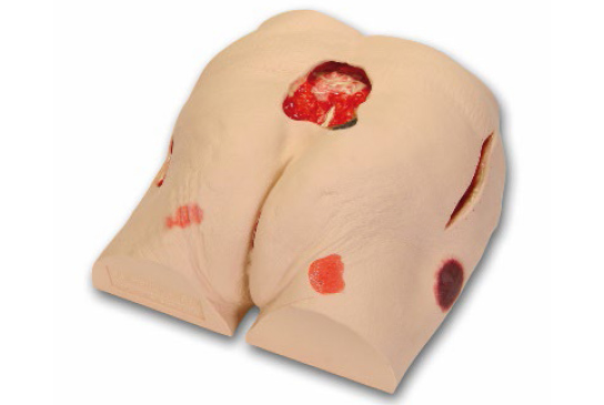 Seymour II Wound Care Model