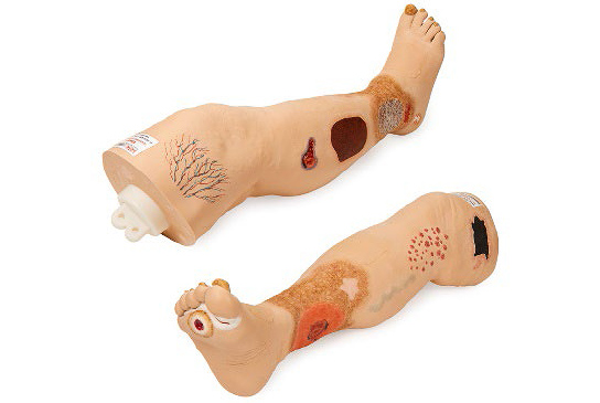 Vinnie Venous Insufficiency Leg Model