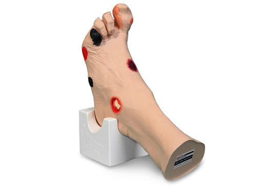 Wilma Foot Wound Model