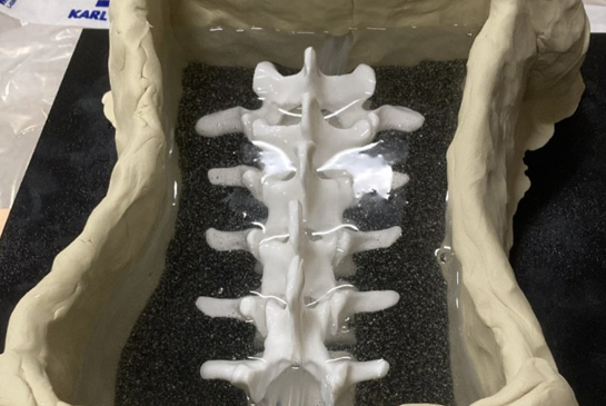 Simulated spine in a gelatin mold.