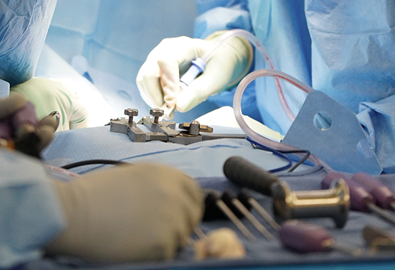 hands holding surgical tools for a spine surgery