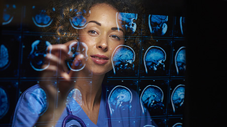 Doctor examining a brain scan