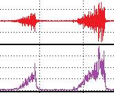 nerve conduction studies at Mather VA