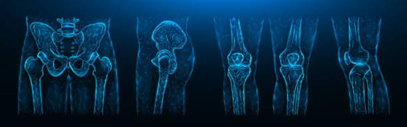 Joint Replacement 