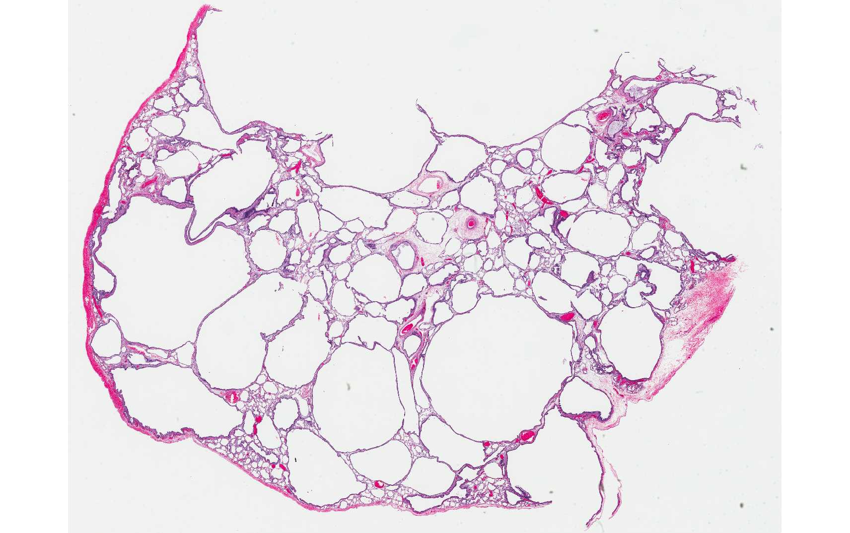 Case of the Month, Feb. 2013: Figure 3