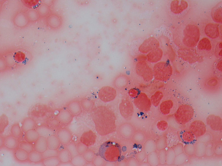 Prussian blue, aspirate smear (1000x)