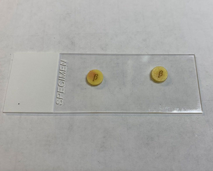 Beta-Lactamase Test