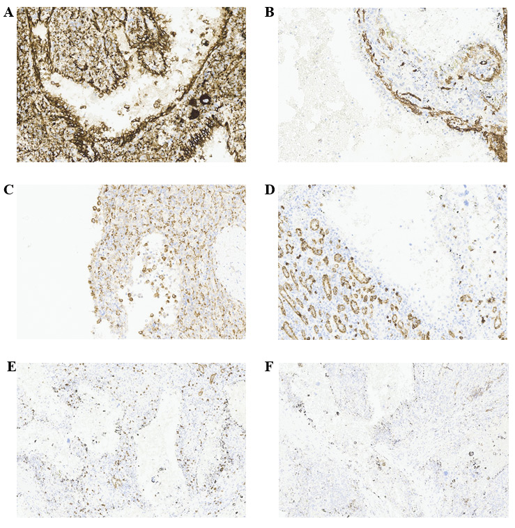 Immunohistochemistry Staining image