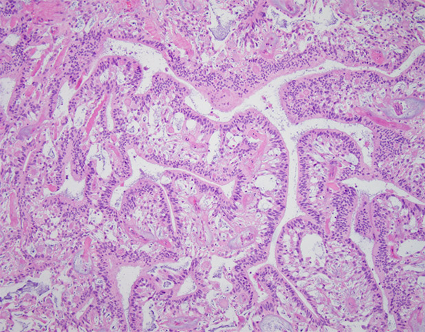 Figure 3. H&E, 10x.