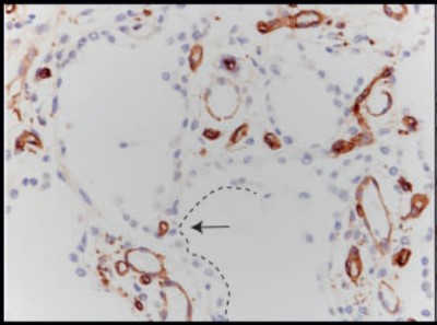 Immunostaining for CD31