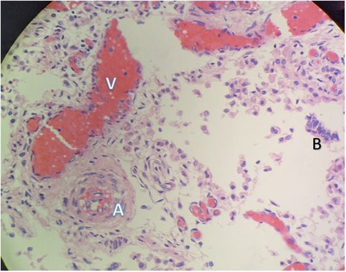 Histomorphological examination of the pulmonary system