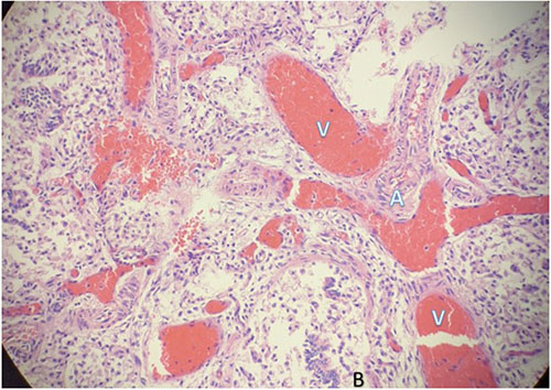 Histomorphological examination of the pulmonary system