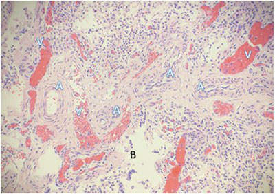 Histomorphological examination of the pulmonary system