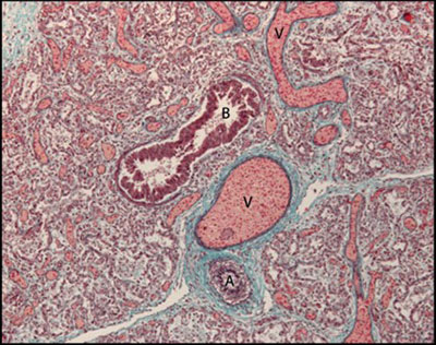 Trichrome stained lung tissue