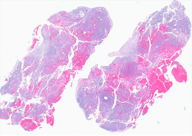 Histologic sections of the resection