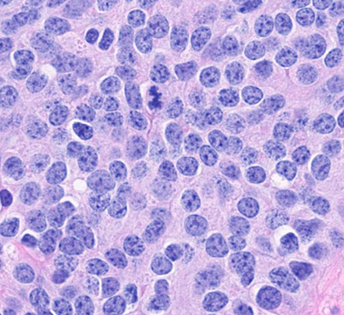 Histologic sections of the resection