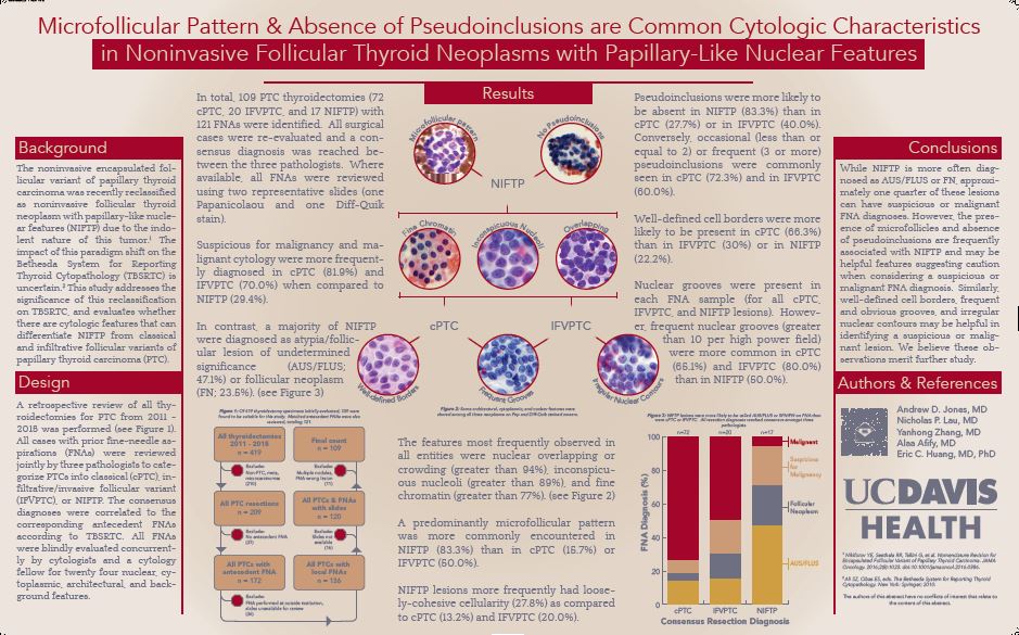 Jones Andrew USCAP 2017 poster